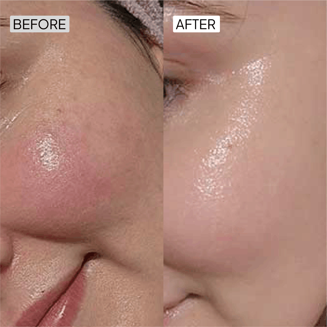 Vitamin C Skin care serum