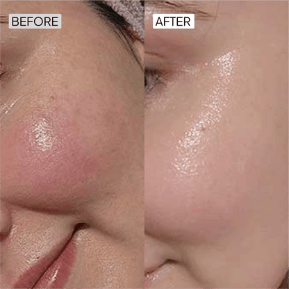 Vitamin C Skin care serum